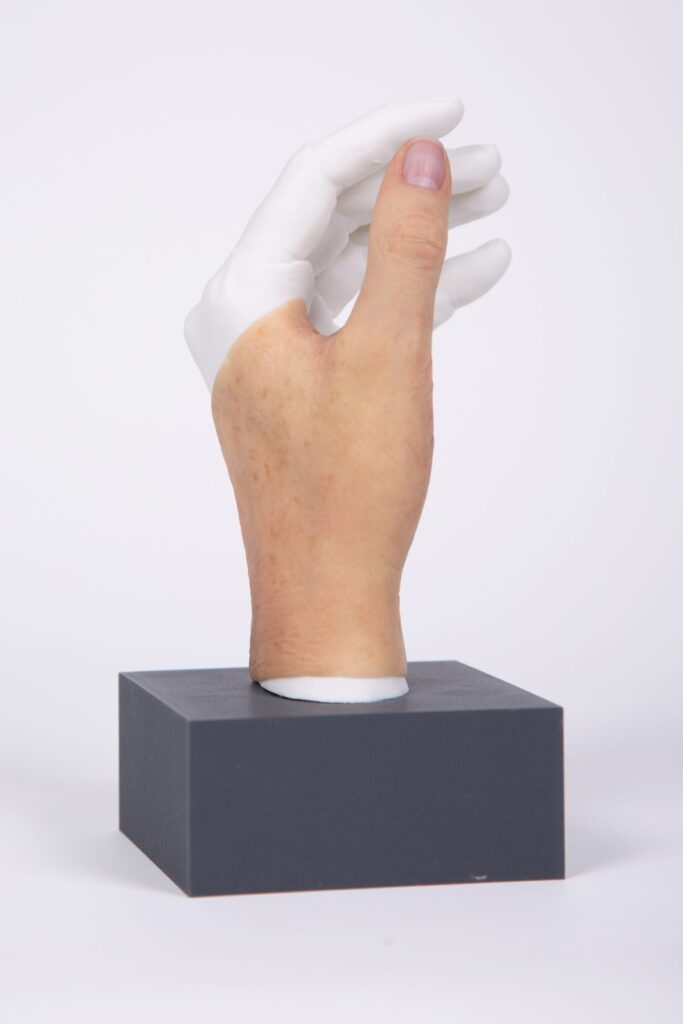 Handprothese aus Silikon auf Sockel – APO-Silikon